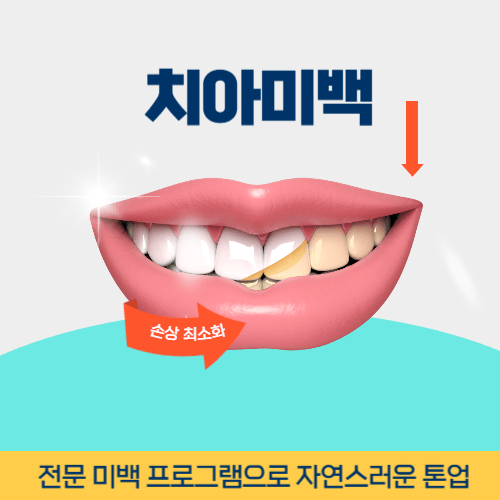 목포치과 목포시 치과 치아미백